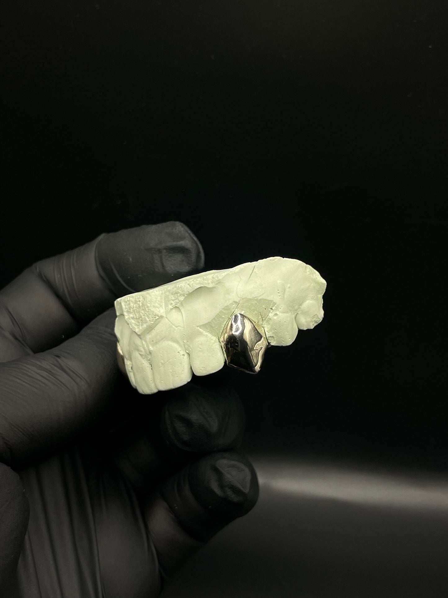 PLAIN SINGLE CAPS - (OPTIONAL), GOLD TOOTH CAP